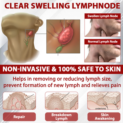LOVILDS® (Official retail store) Red Vine Fluid Relief Edema Gel