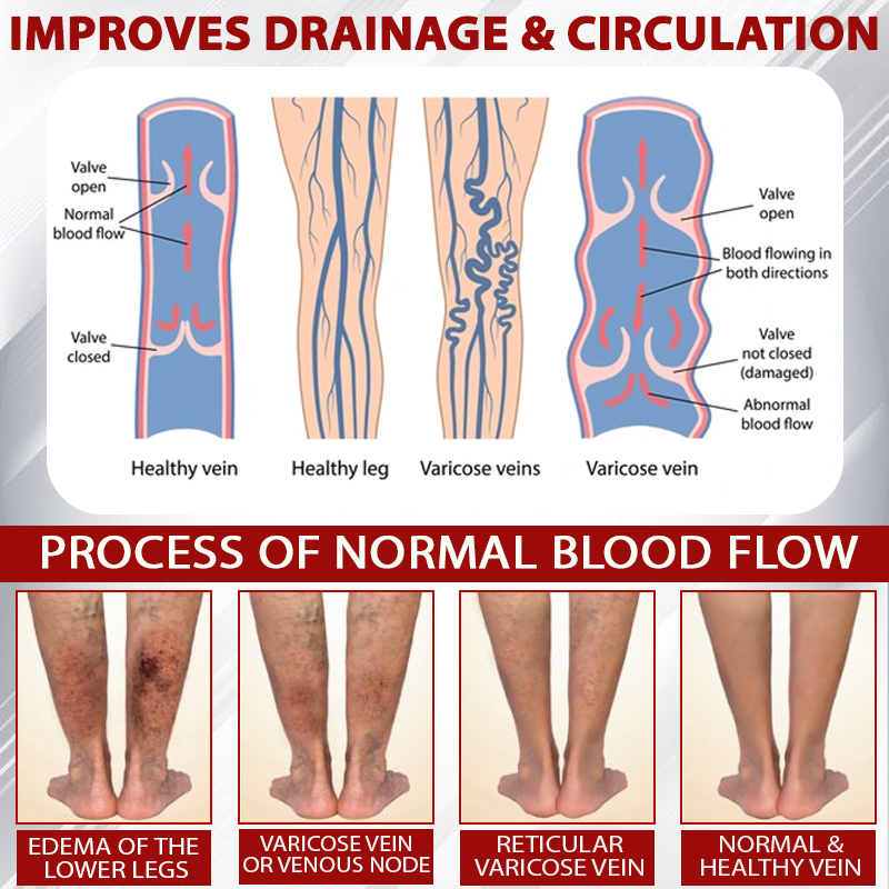 LOVILDS® (Official retail store) Red Vine Fluid Relief Edema Gel