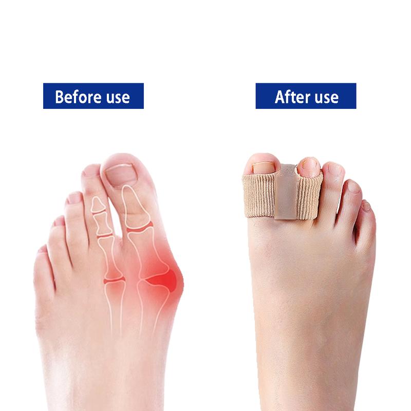 Neslemy™ Premium Elastic Toe Separators – Comfortable Pain Relief & Alignment