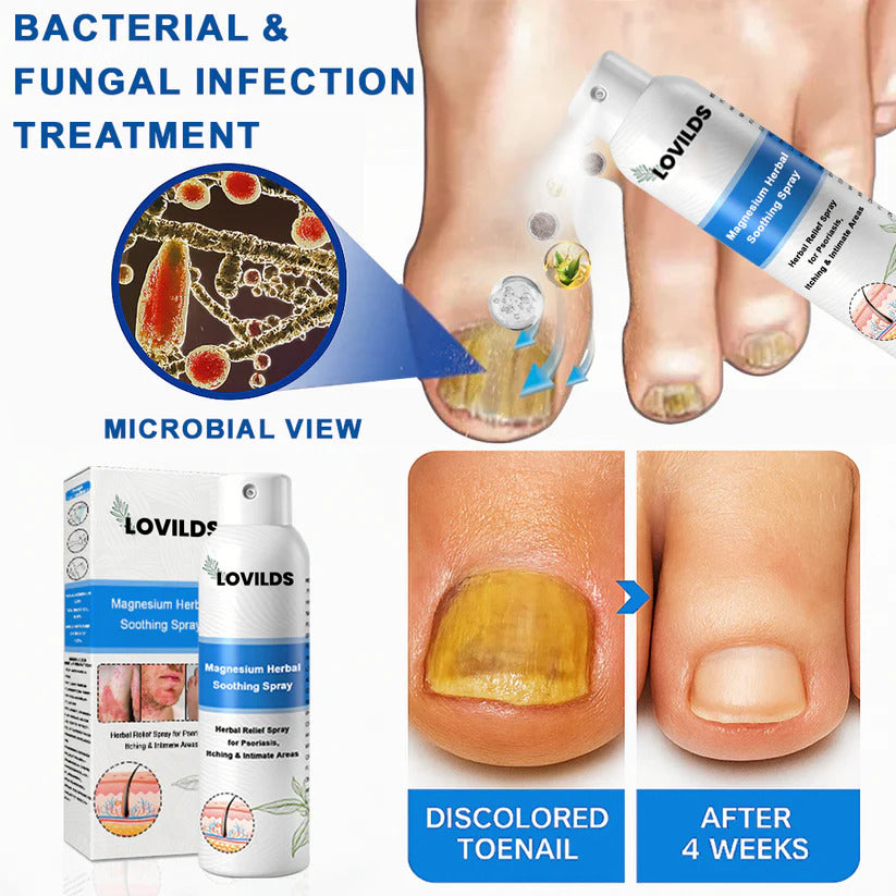 ✅ Official Store: LOVILDS® Magnesium Herbal Psoriasis Spray ⚕️ FDA Certified (Relieves psoriasis and eczema, improves bacterial infections in the genital area, treats acne and warts, relieves joint pain and neuropathic pain)