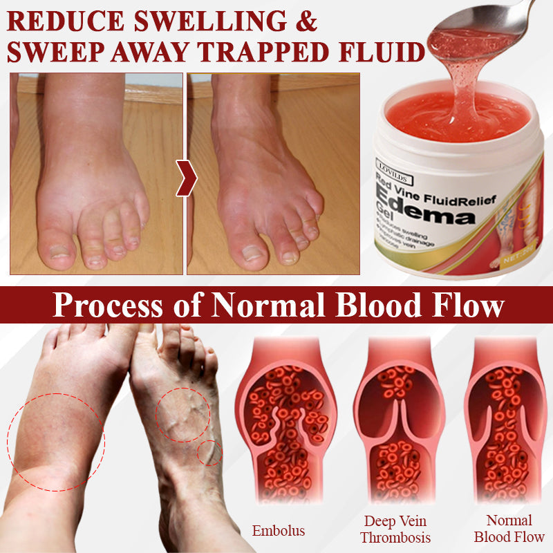 LOVILDS® (Official retail store） Red Vine Fluid Relief Edema Gel