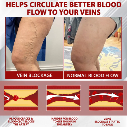 LOVILDS® (Official retail store） Red Vine Fluid Relief Edema Gel
