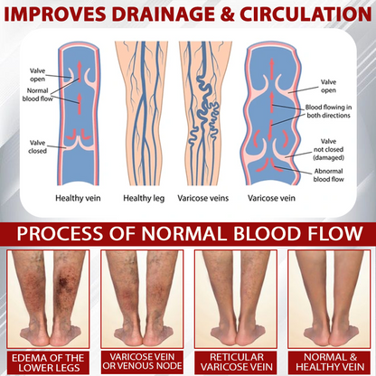 LOVILDS® (Official retail store） Red Vine Fluid Relief Edema Gel