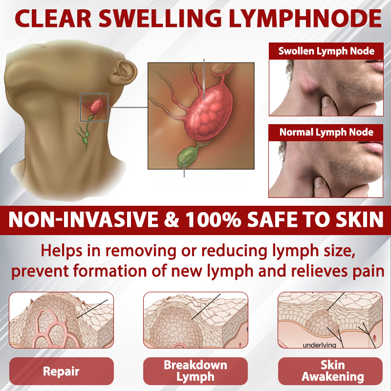 LOVILDS® (Official retail store） Red Vine Fluid Relief Edema Gel