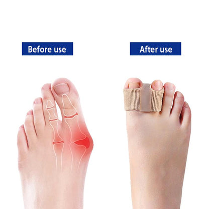Neslemy™ Premium Elastic Toe Separators – Comfortable Pain Relief & Alignment