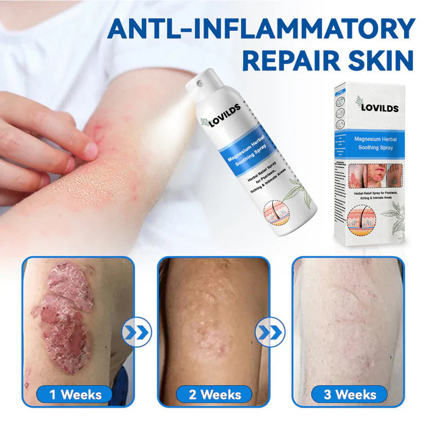 ✅ Official Store: LOVILDS® Magnesium Herbal Psoriasis Spray ⚕️ FDA Certified (Relieves psoriasis and eczema, improves bacterial infections in the genital area, treats acne and warts, relieves joint pain and neuropathic pain)