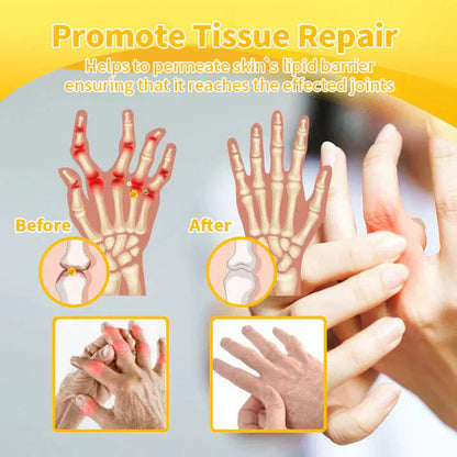 LOVILDS™Bee poison Pain Relief and Bone Care Ointment